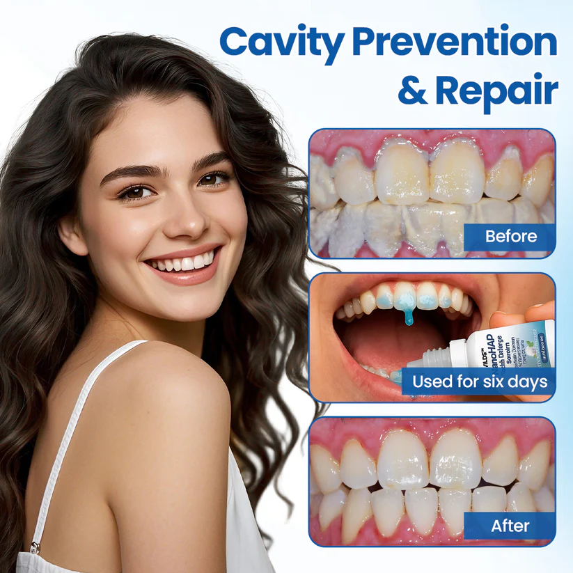 Lyyeto® NanoHAP Tooth Defense Serum