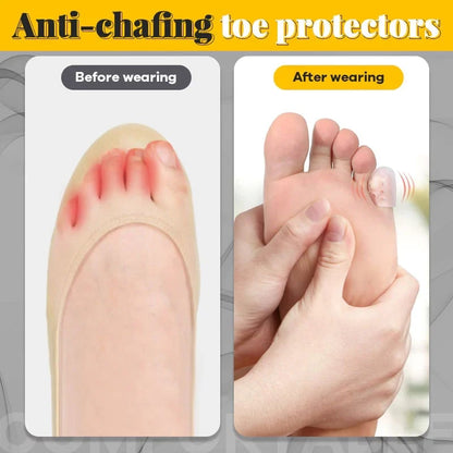 Luhaka®🔥Silicone anti-friction toe protector