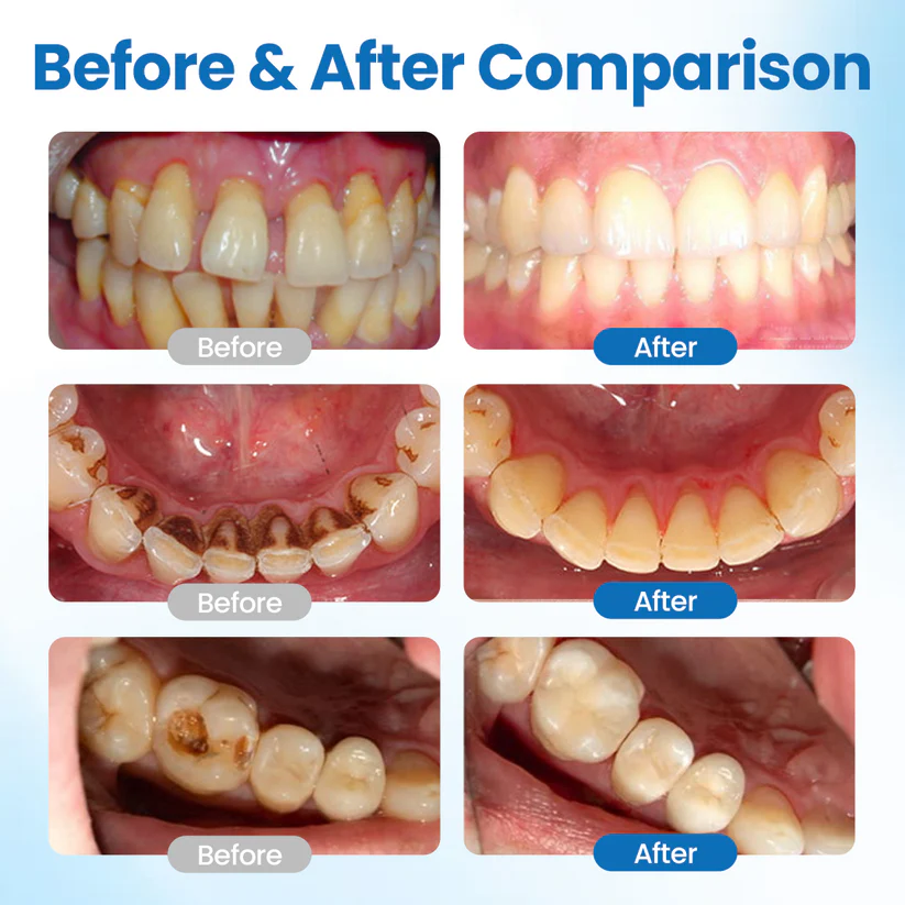 Lyyeto®  NanoHAP Tooth Defense Serum