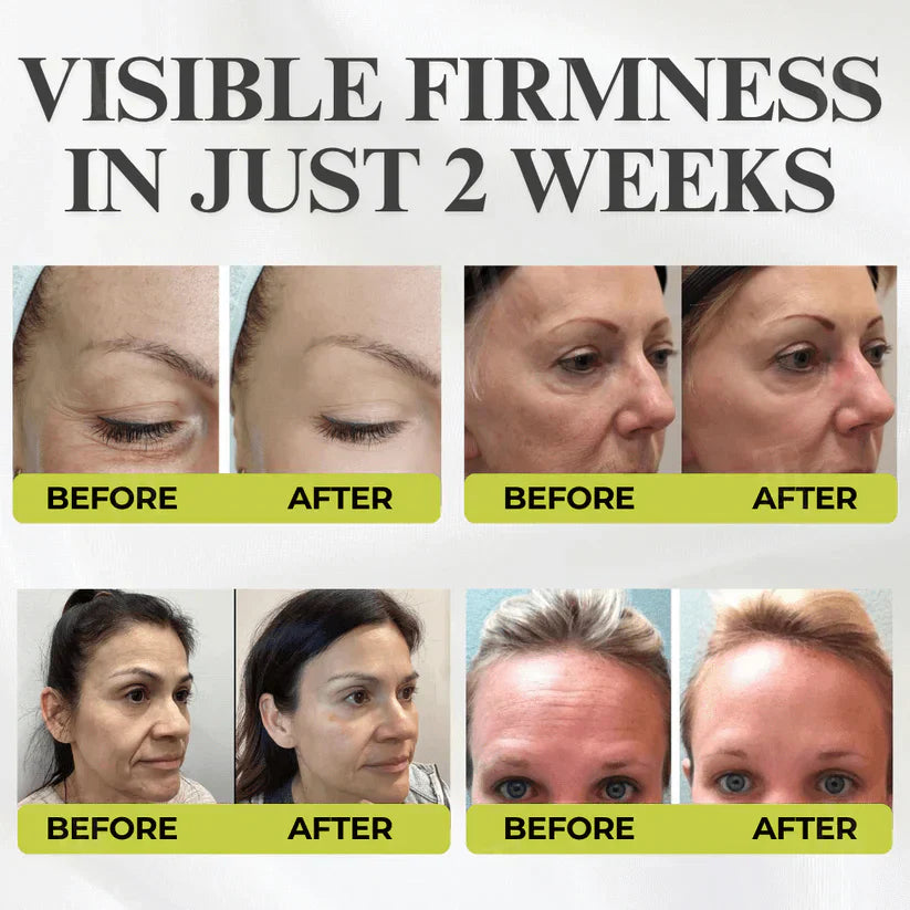 👏🌿Made and shipped from the USA 💫Luhaka® Botox & Vita-A Retinol Shot Wrinkle-Lift Tightening cream - Last Day Promotion 70% OFF