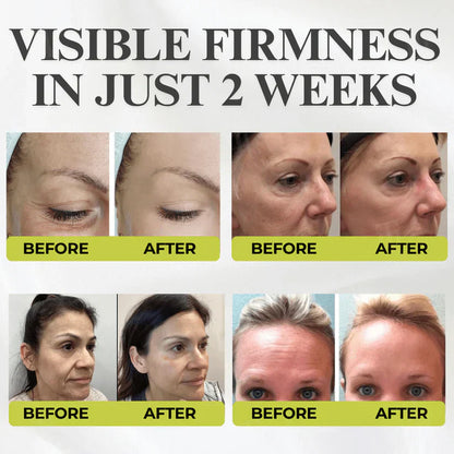 👏🌿Made and shipped from the USA 💫Luhaka® Botox & Vita-A Retinol Shot Wrinkle-Lift Tightening cream - Last Day Promotion 70% OFF