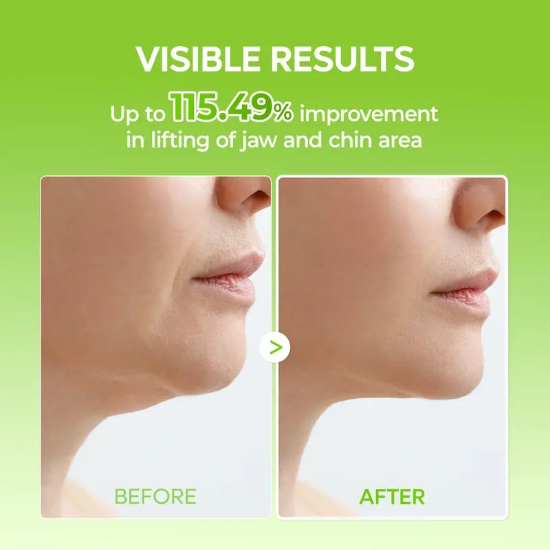 Luhaka®	🌿V-Lifting Mewing Band – Cactus Cooling. Reduces Puffiness & Tightens Pores