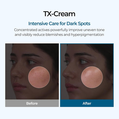 Luhaka®  🧪TX Cream Nano-sized Tranexaminc Acid for Dark Spots & Hyperpigmentation
